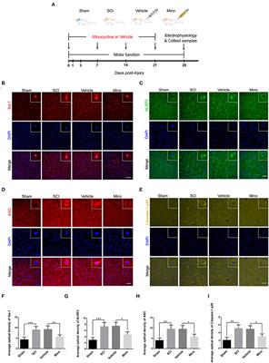 Microglial activation in the motor cortex mediated NLRP3-related neuroinflammation and neuronal damage following spinal cord injury